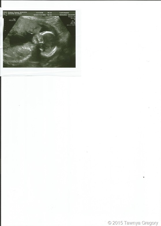 Profile- Ultrasound Picture